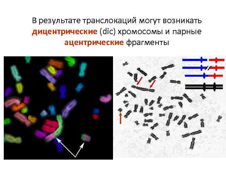В результате транслокаций могут возникать дицентрические (dic) хромосомы и парные ацентрические фрагменты 