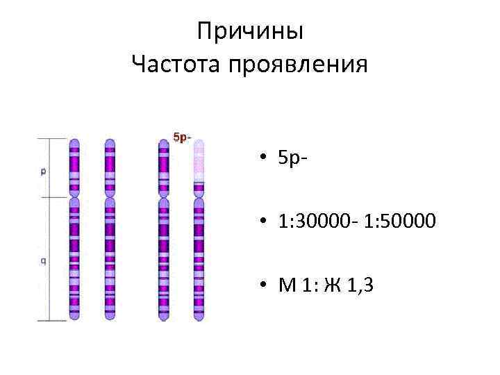 Причины Частота проявления • 5 p • 1: 30000 1: 50000 • М 1: