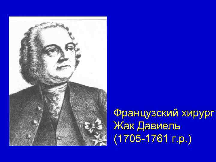 Французский хирург Жак Давиель (1705 -1761 г. р. ) 