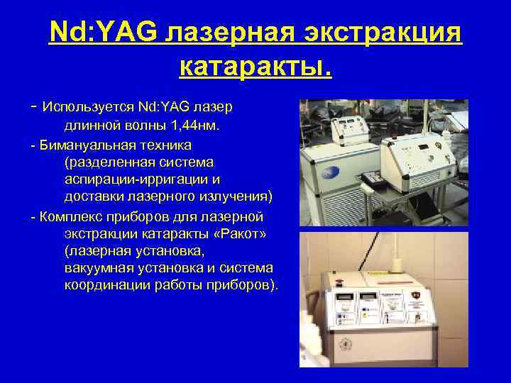 Nd: YAG лазерная экстракция катаракты. - Используется Nd: YAG лазер длинной волны 1, 44