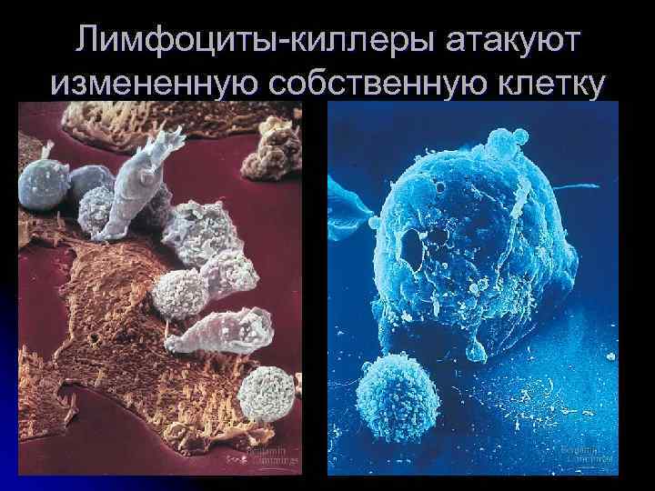 Лимфоциты-киллеры атакуют измененную собственную клетку 