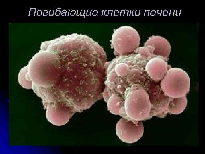Погибающие клетки печени 