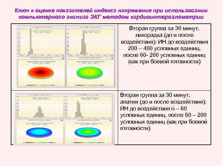 Ключ к оценке показателей индекса напряжения при использовании компьютерного анализа ЭКГ методом кардиоинтервалометрии Вторая