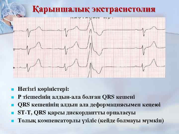 Қарыншалық экстрасистолия n n n Негізгі көріністері: Р тісшесінің алдын-ала болған QRS кешенінің алдын