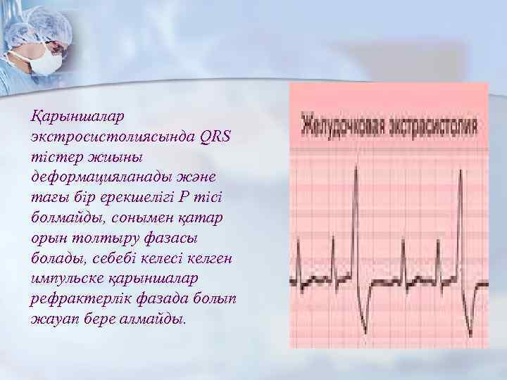 Қарыншалар экстросистолиясында QRS тістер жиыны деформацияланады және тағы бір ерекшелігі Р тісі болмайды, сонымен