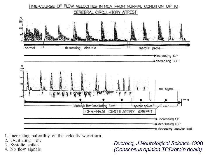 Ducrocq, J Neurological Science 1998 (Consensus opinion TCD/brain death) 