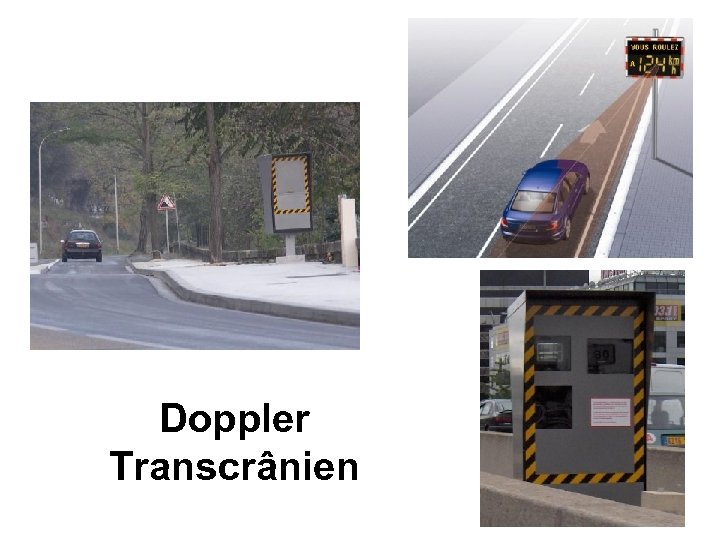 Doppler Transcrânien 