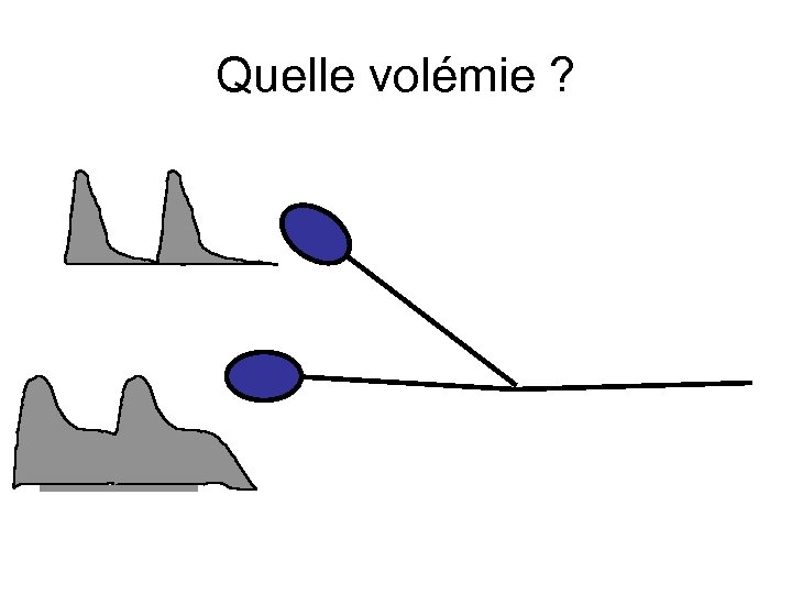 Quelle volémie ? 