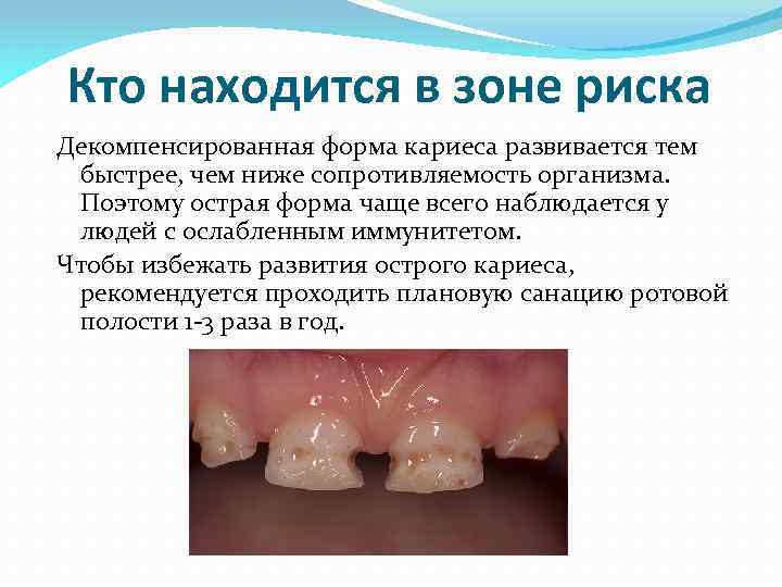 Кто находится в зоне риска Декомпенсированная форма кариеса развивается тем быстрее, чем ниже сопротивляемость