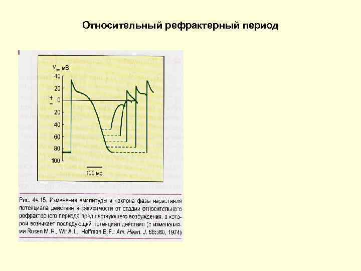 Относительный рефрактерный период 