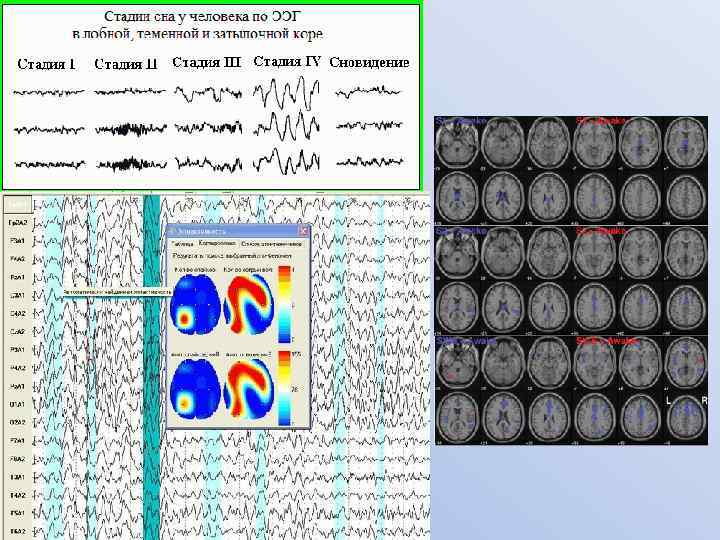  • медленный 