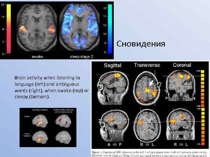  • Сновидения Brain activity when listening to language (left) and ambiguous words (right),
