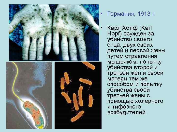  • Германия, 1913 г. • Карл Хопф (Karl Hopf) осужден за убийство своего