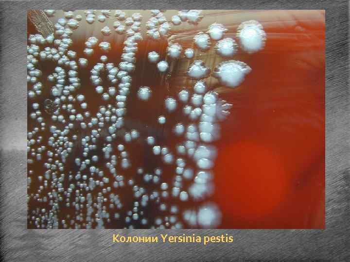 Колонии Yersinia pestis 