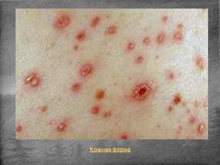 Кожная форма 