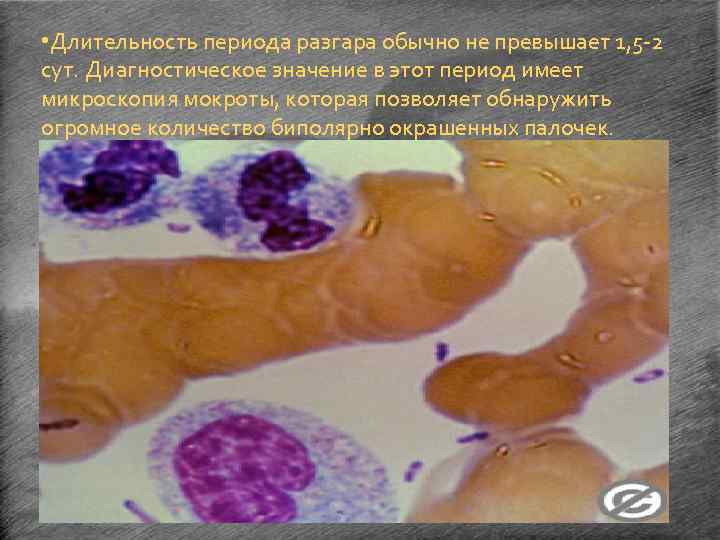  • Длительность периода разгара обычно не превышает 1, 5 -2 сут. Диагностическое значение