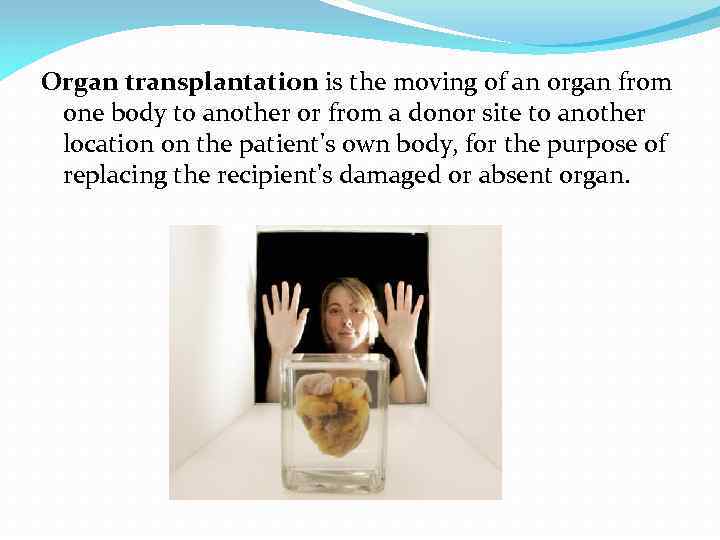 Organ transplantation is the moving of an organ from one body to another or