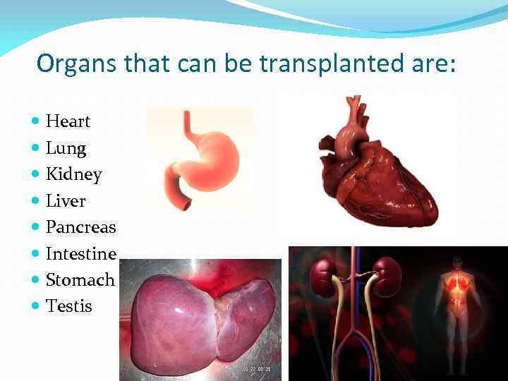 Organs that can be transplanted are: Heart Lung Kidney Liver Pancreas Intestine Stomach Testis