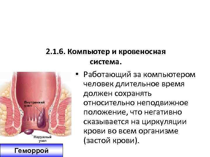 2. 1. 6. Компьютер и кровеносная система. • Работающий за компьютером человек длительное время