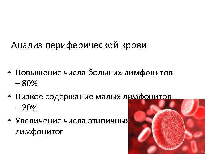 Анализ периферической крови • Повышение числа больших лимфоцитов – 80% • Низкое содержание малых