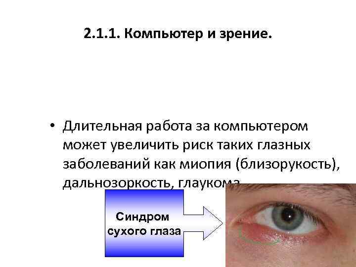 2. 1. 1. Компьютер и зрение. • Длительная работа за компьютером может увеличить риск