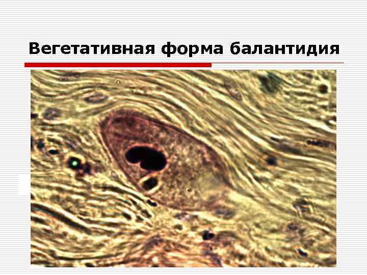 Вегетативная форма балантидия 