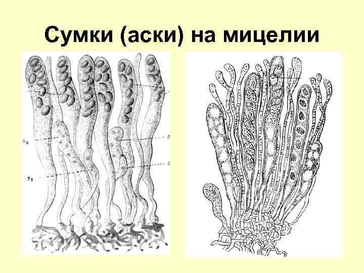 Сумки (аски) на мицелии 