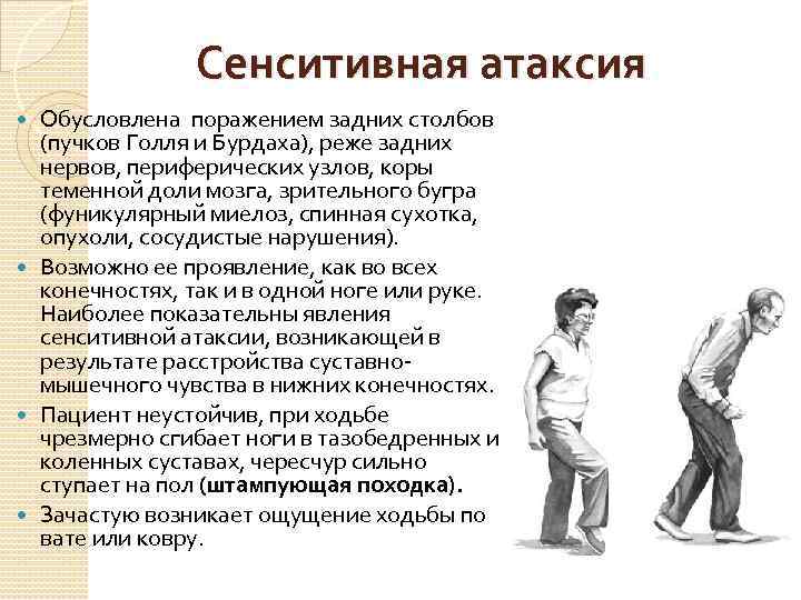 Сенситивная атаксия Обусловлена поражением задних столбов (пучков Голля и Бурдаха), реже задних нервов, периферических