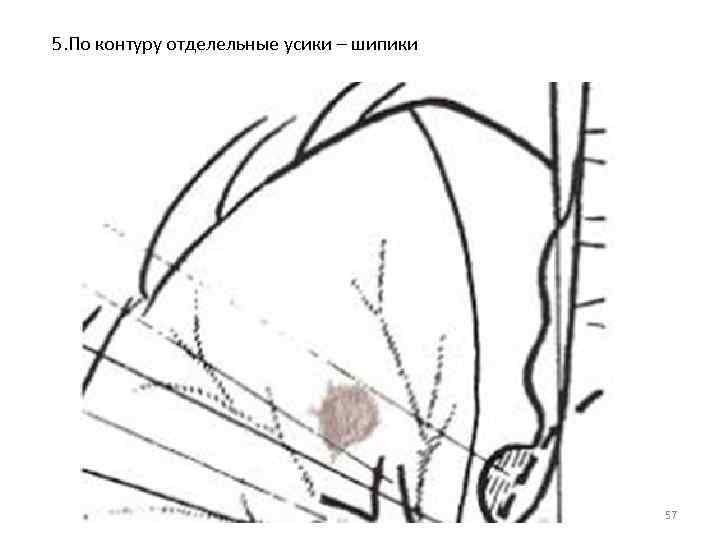  5. По контуру отделельные усики – шипики 57 