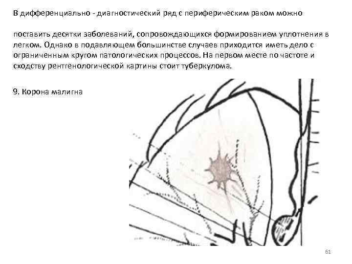 В дифференциально - диагностический ряд с периферическим раком можно поставить десятки заболеваний, сопровождающихся формированием