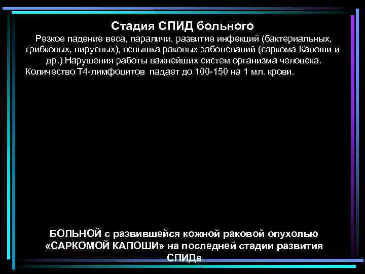 Стадия СПИД больного Резкое падение веса, параличи, развитие инфекций (бактериальных, грибковых, вирусных), вспышка раковых