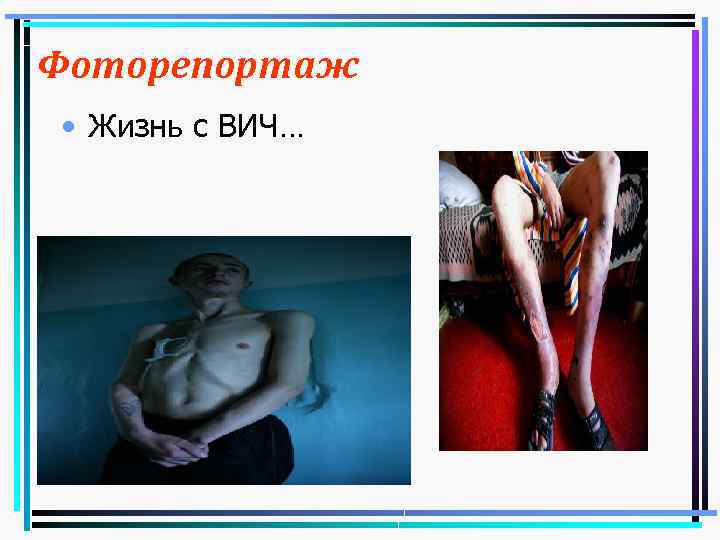 Фоторепортаж • Жизнь с ВИЧ… 