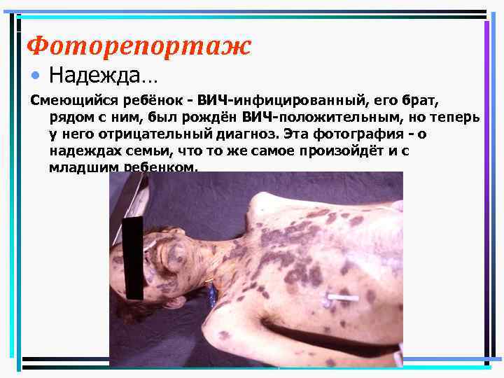 Фоторепортаж • Надежда… Смеющийся ребёнок - ВИЧ-инфицированный, его брат, рядом с ним, был рождён