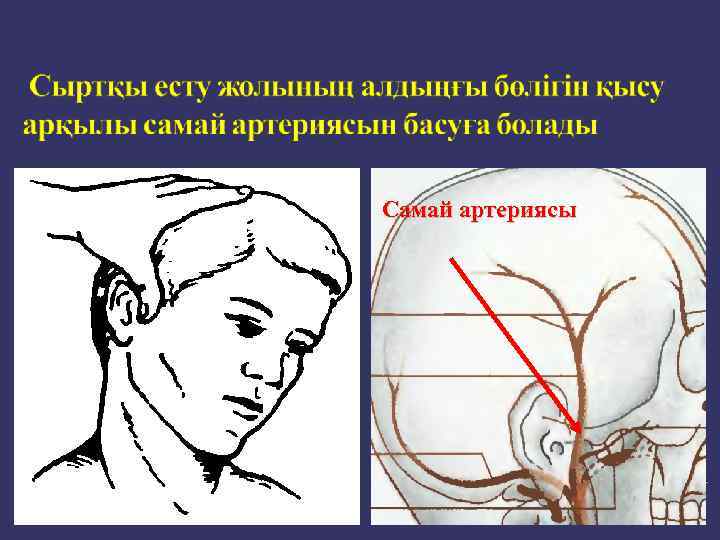 Самай артериясы 