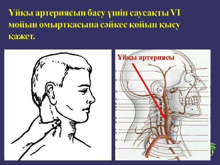 Ұйқы артериясы 