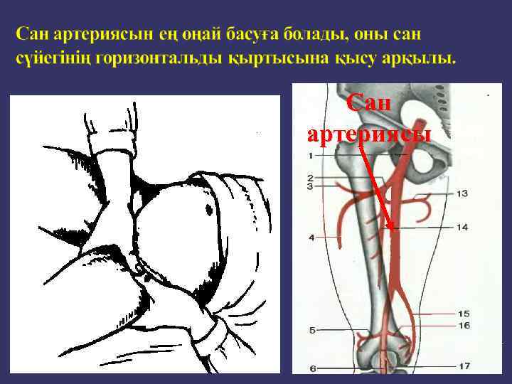 Сан артериясы 