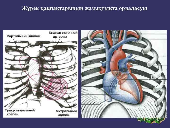 Жүрек қақпақтарының жазықтықта орналасуы 