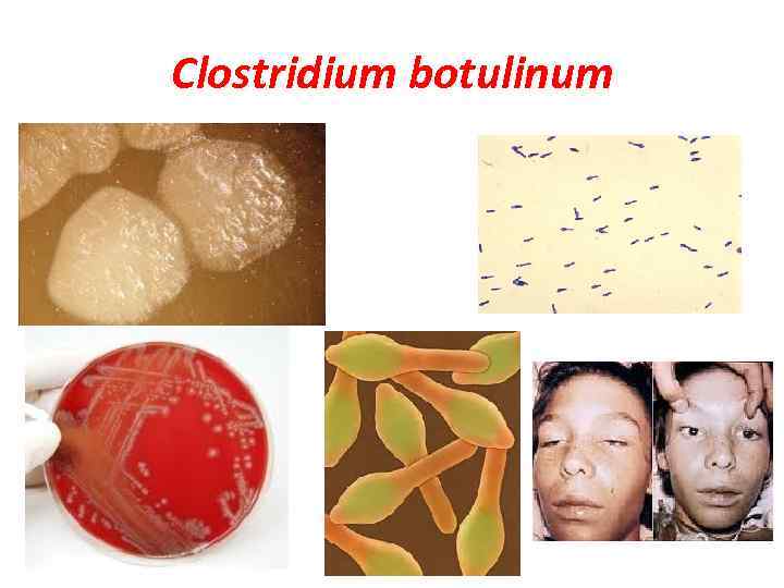 Clostridium botulinum 