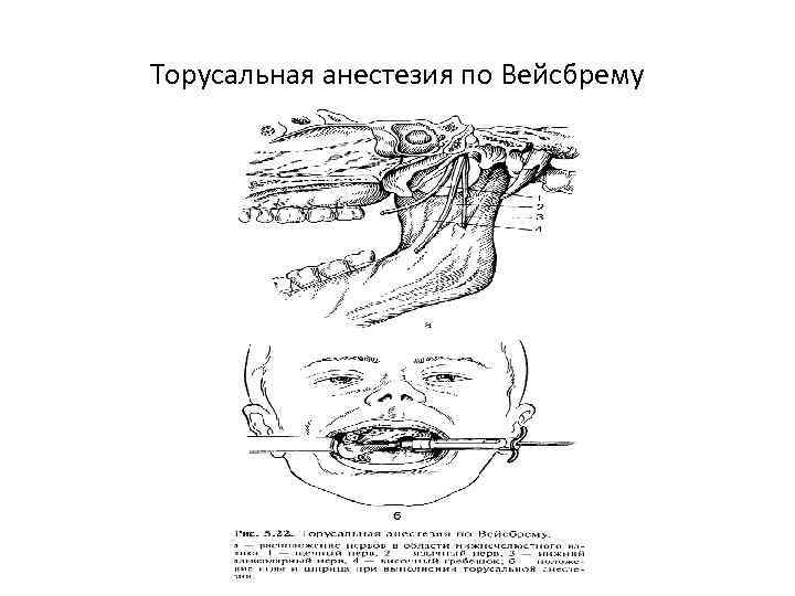 Проводниковой анестезии на лице