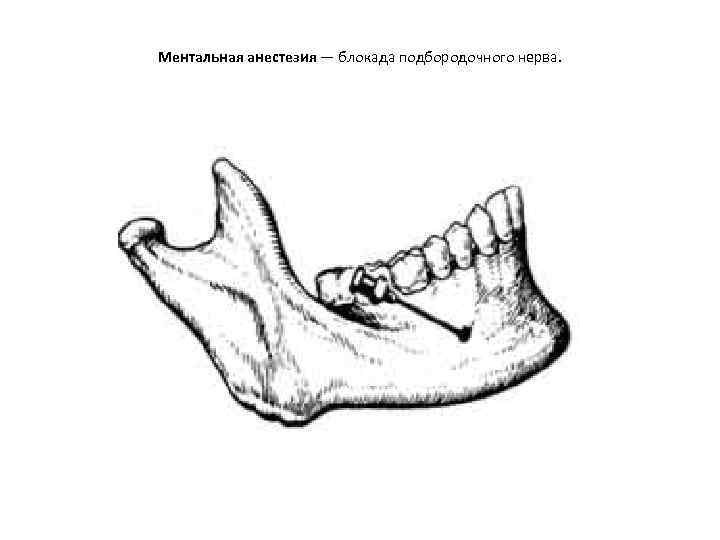 Ментальная анестезия — блокада подбородочного нерва. 
