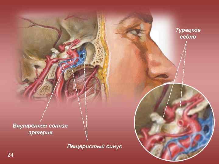 Турецкое седло