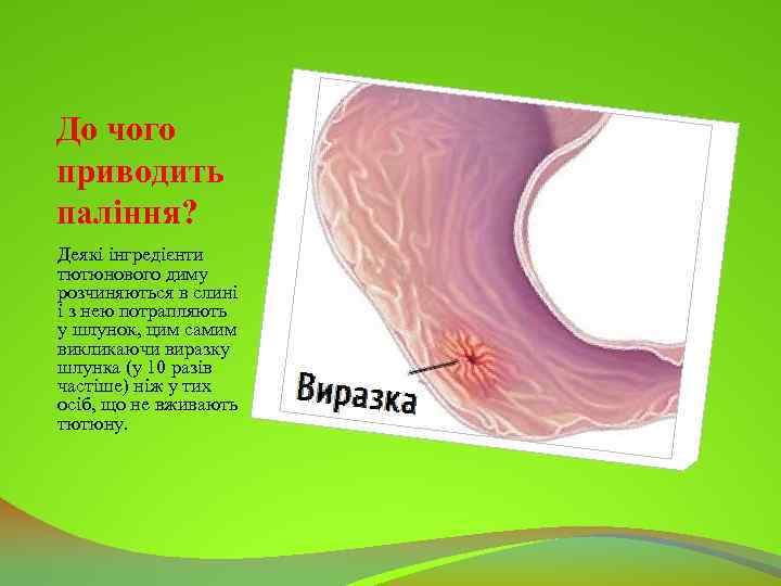 До чого приводить паління? Деякі інгредієнти тютюнового диму розчиняються в слині і з нею