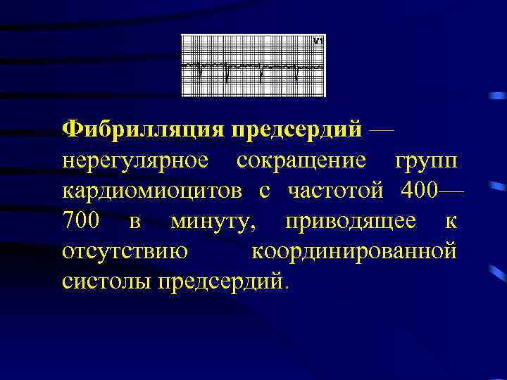 Фибрилляция предсердий — нерегулярное сокращение групп кардиомиоцитов с частотой 400— 700 в минуту, приводящее