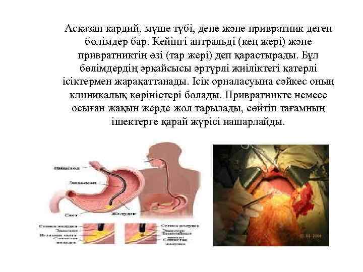 Асқазан кардий, мүше түбі, дене және привратник деген бөлімдер бар. Кейінгі антральді (кең жері)