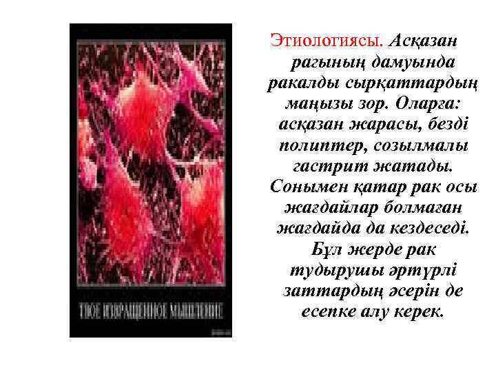 Этиологиясы. Асқазан рагының дамуында ракалды сырқаттардың маңызы зор. Оларға: асқазан жарасы, безді полиптер, созылмалы