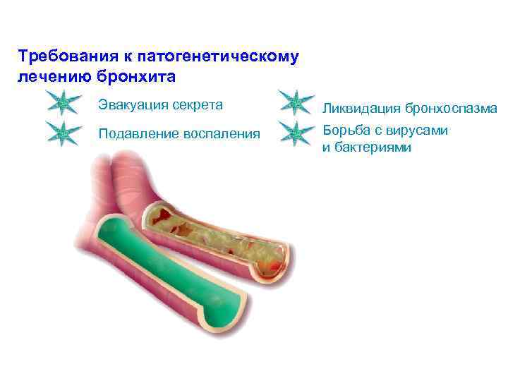 Требования к патогенетическому лечению бронхита Эвакуация секрета Ликвидация бронхоспазма Подавление воспаления Борьба с вирусами