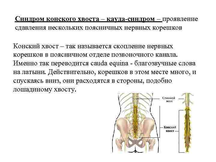 Передний столб спинного мозга. Спинной мозг строение конский хвост. Поражение конского хвоста спинного мозга. Симптомы компрессии Корешков конского хвоста.