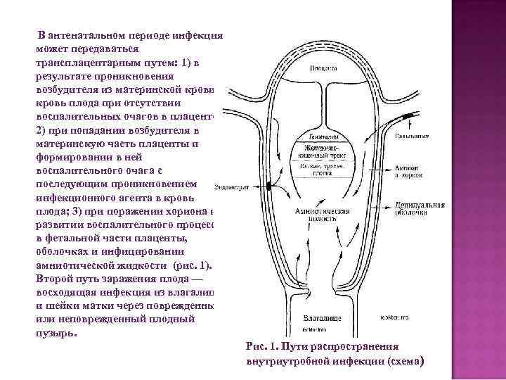 В антенатальном периоде инфекция может передаваться трансплацентарным путем: 1) в результате проникновения возбудителя из
