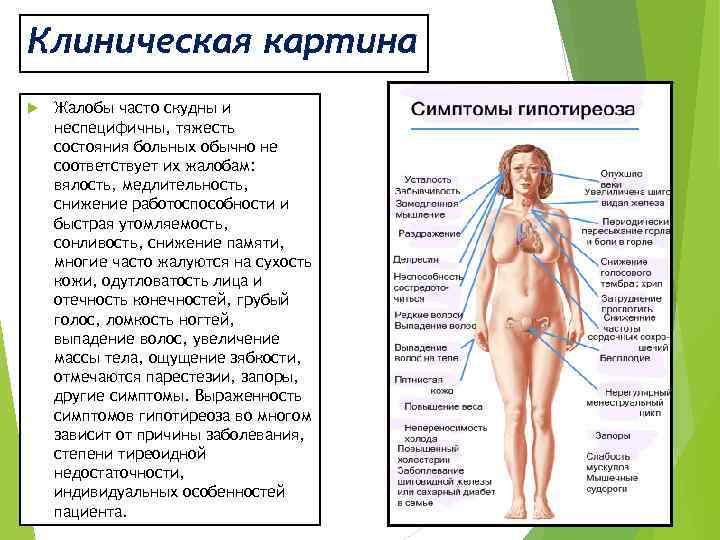 Клиническая картина Жалобы часто скудны и неспецифичны, тяжесть состояния больных обычно не соответствует их