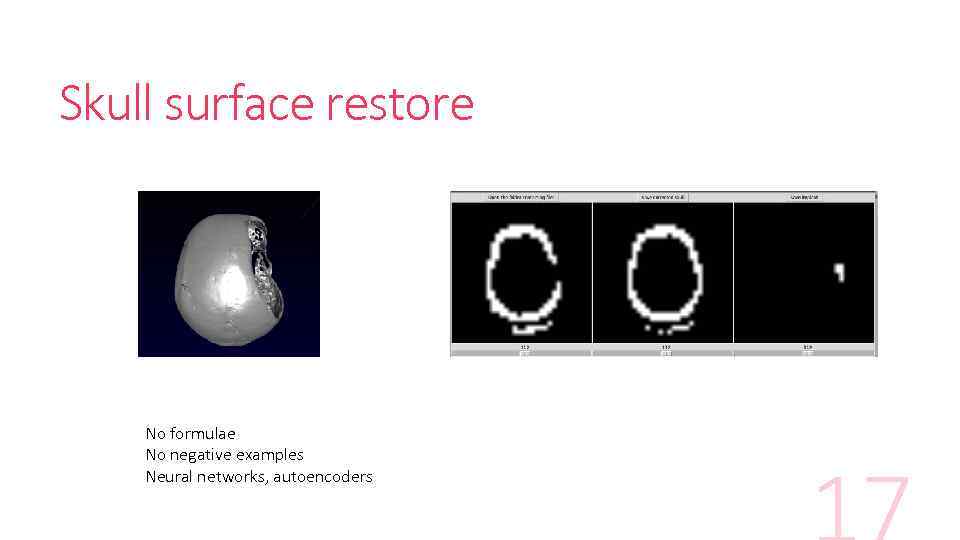 Skull surface restore No formulae No negative examples Neural networks, autoencoders 